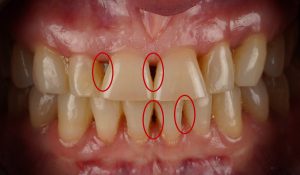 troneras triangulos eugenia cervantes Eugenia Cervantes | Clínica Dental en Madrid