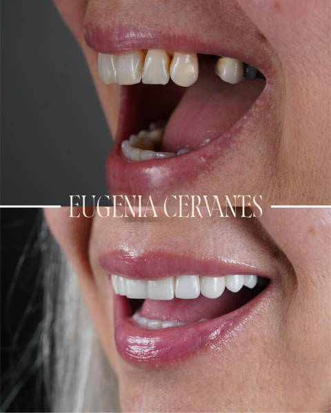 Sin titulo 600 x 600 Eugenia Cervantes | Clínica Dental en Madrid