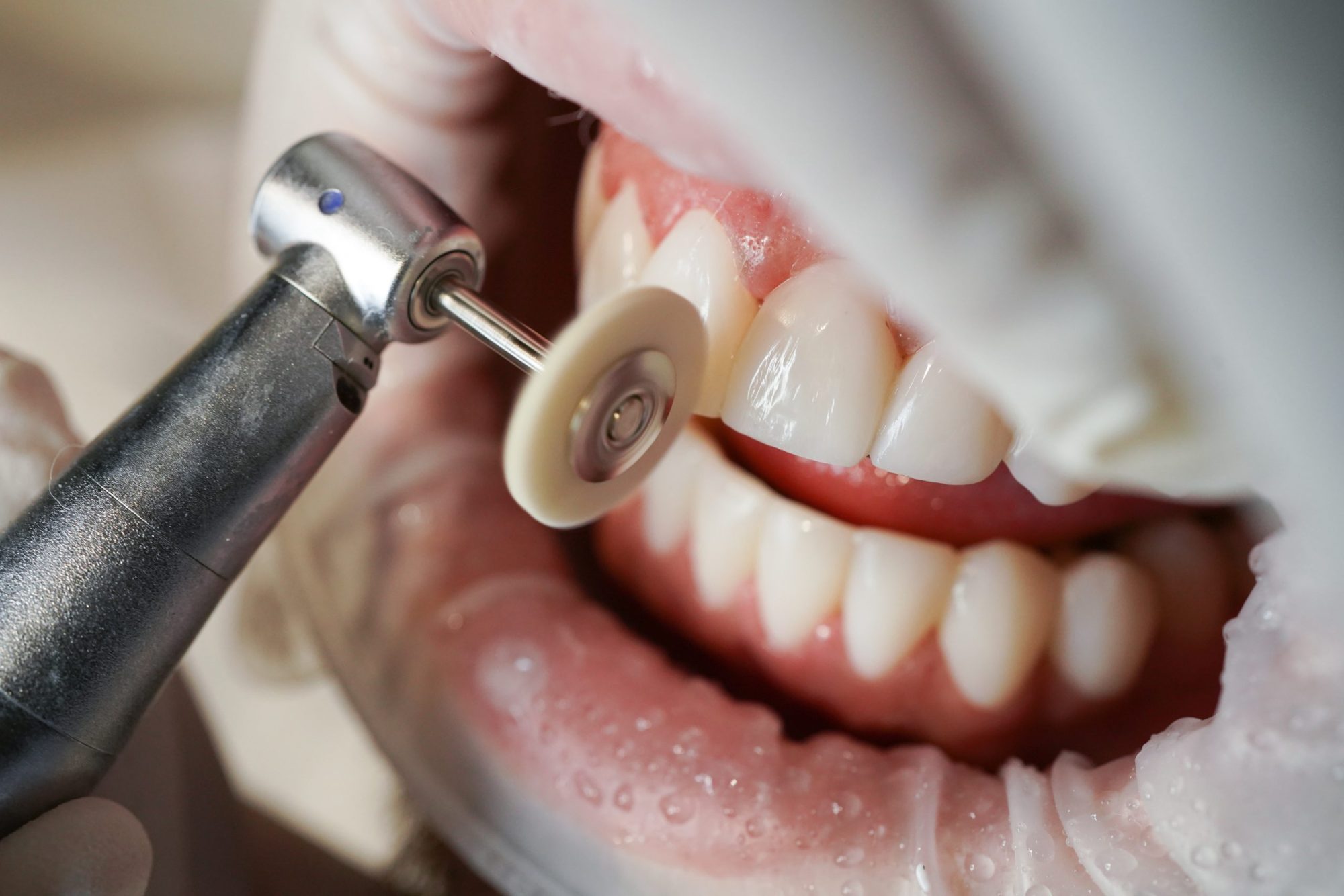 DSC02957 scaled e1762275297454 Eugenia Cervantes | Clínica Dental en Madrid